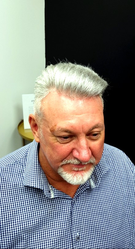 The same client after their Tuffs hair system