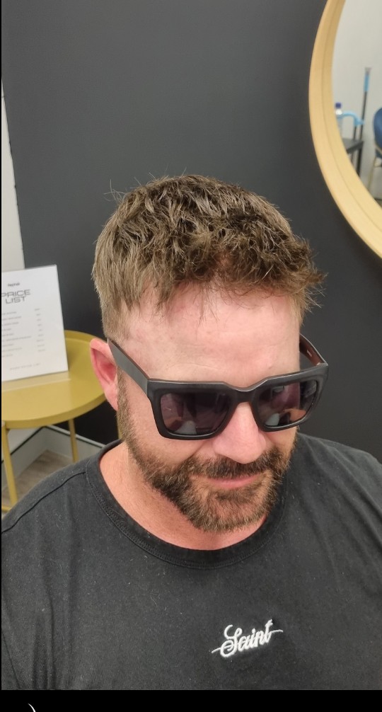 The same client after their Tuffs hair system