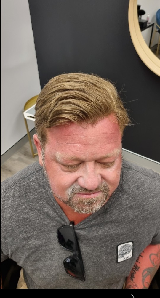 The same client after their Tuffs hair system