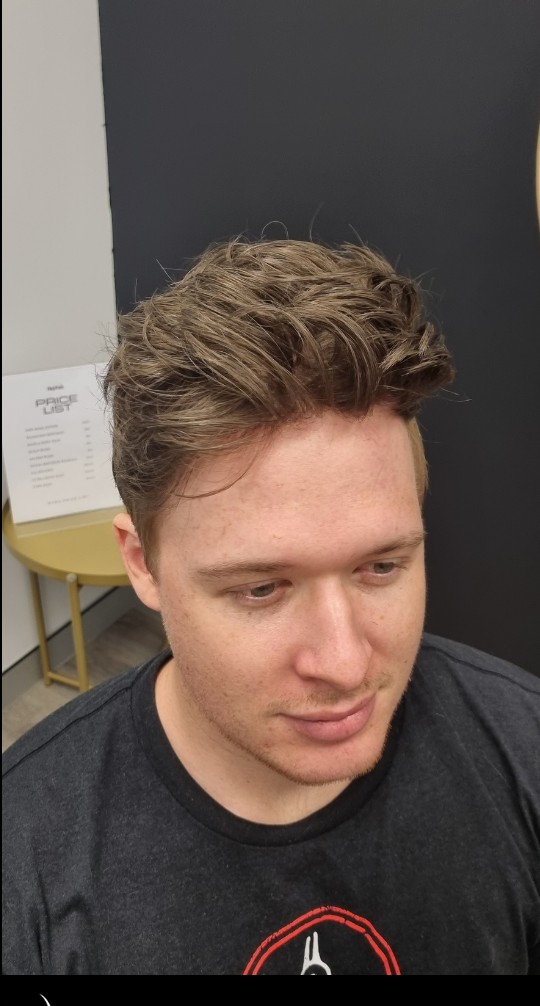 The same client after their Tuffs hair system