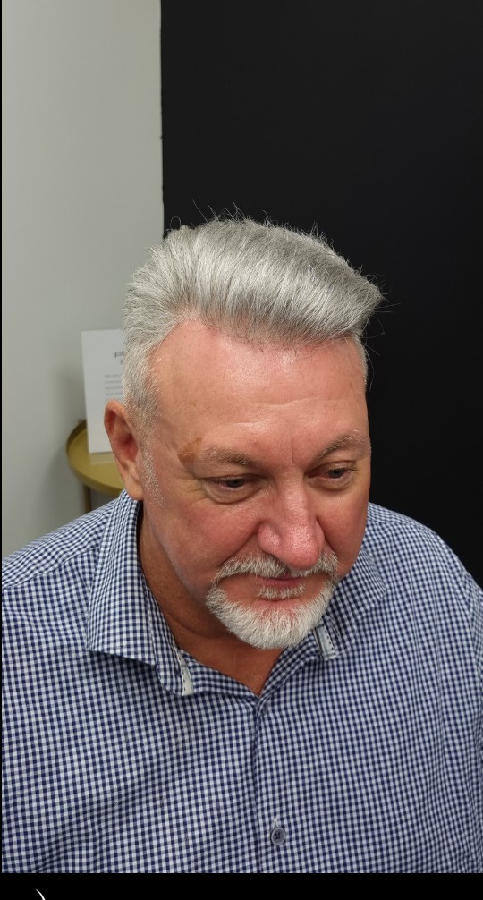 The same client after their Tuffs hair system
