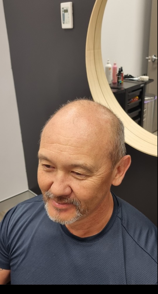 Client before their Tuffs hair system