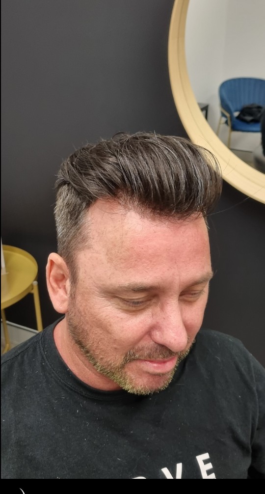 The same client after their Tuffs hair system