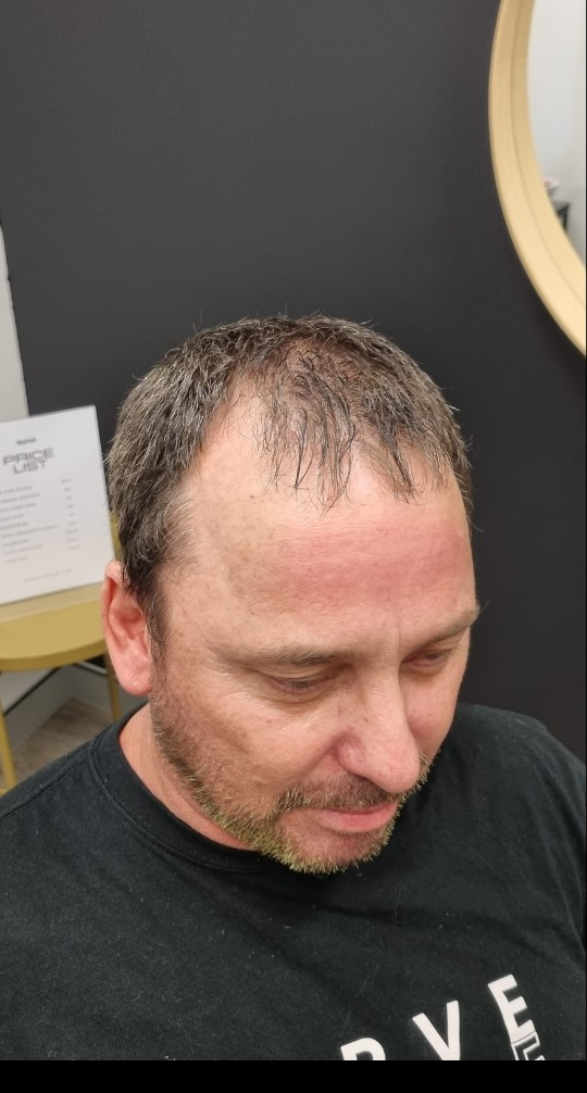 Client before their Tuffs hair system